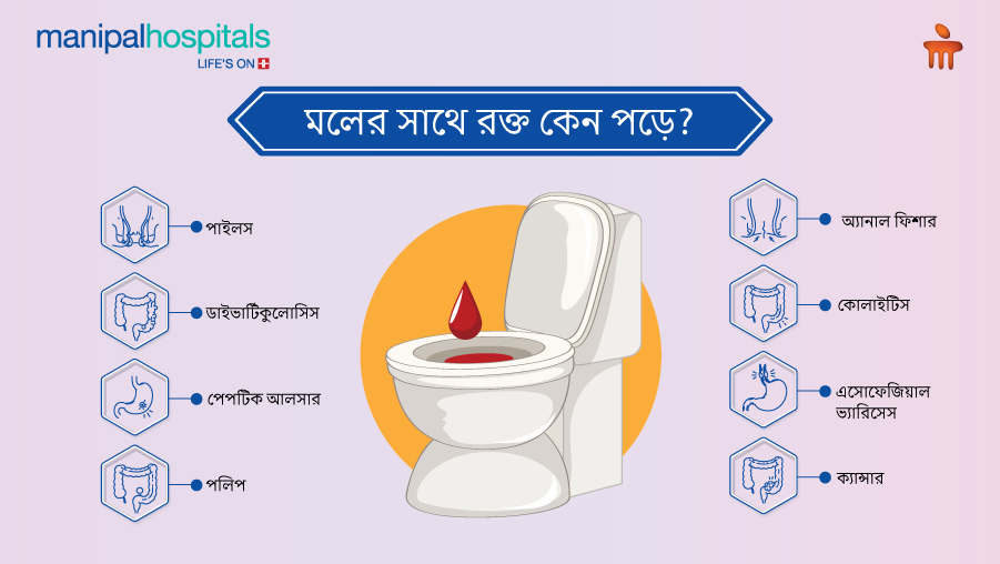 মলের সাথে রক্ত: কারণ, লক্ষণ ও কখন ডাক্তার দেখাবেন