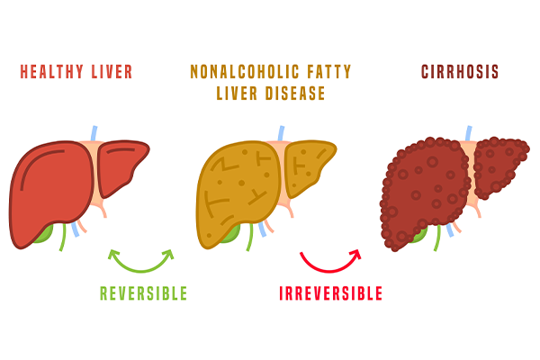 World Liver Day 2025: Food is Medicine for Liver Health