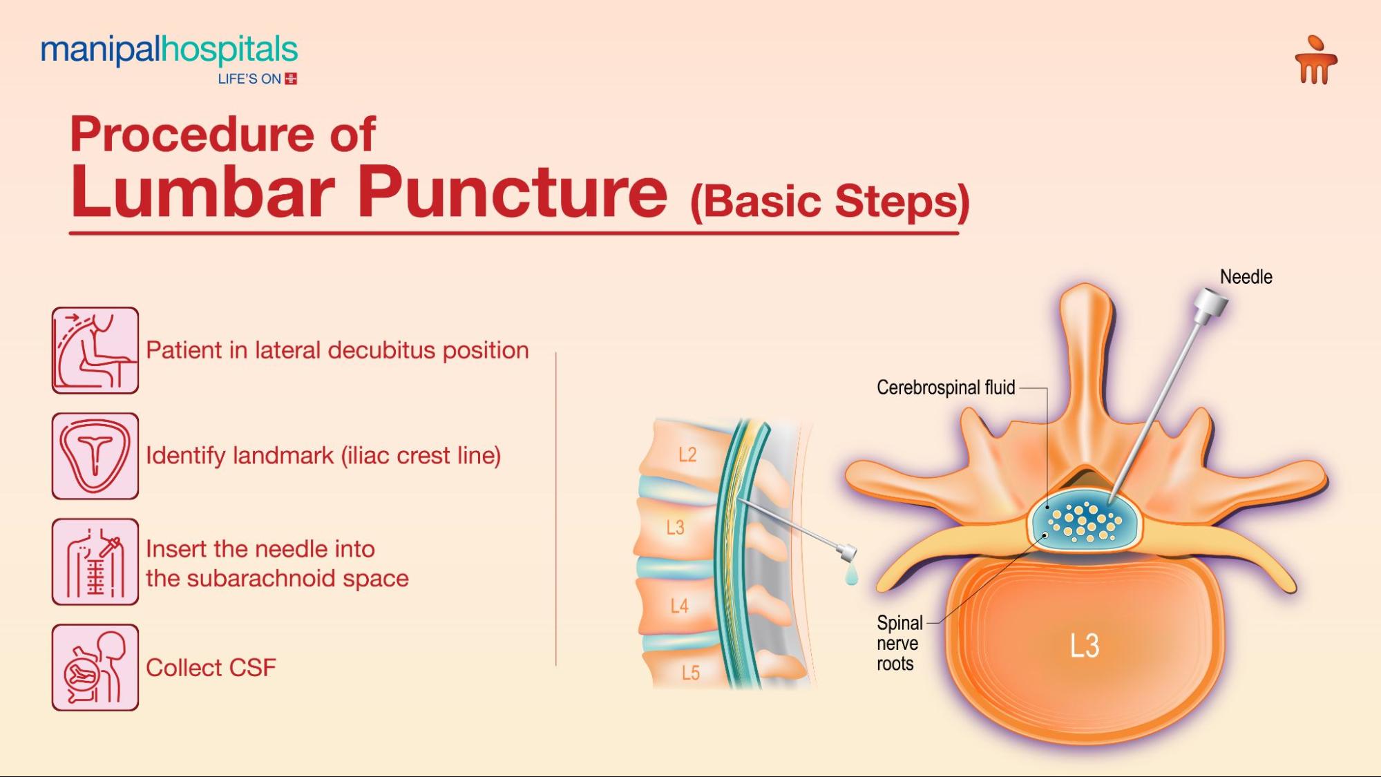 lumbar puncture procedure