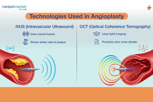 angioplasty procedure