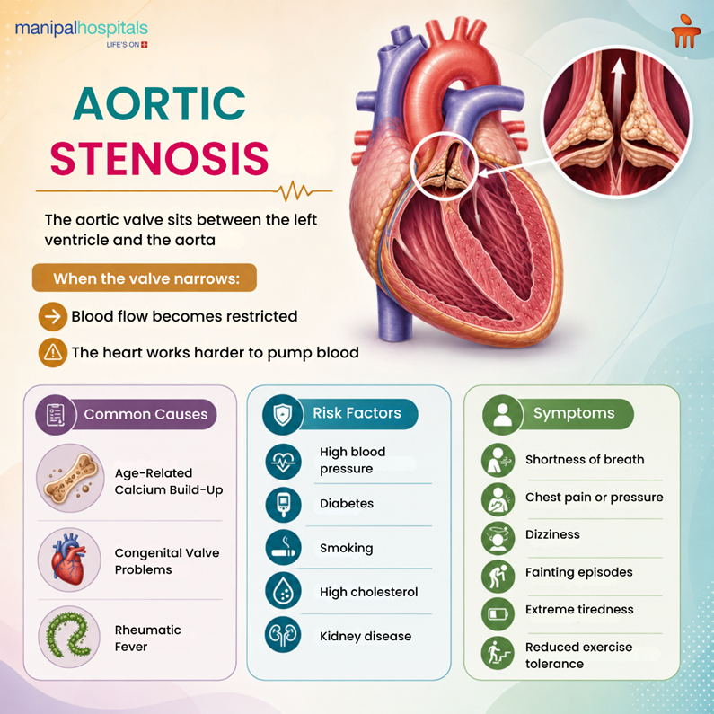aortic-stenosis-heart-valve-narrowing