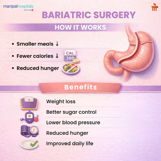 bariatric-surgery-types-benefits-risks
