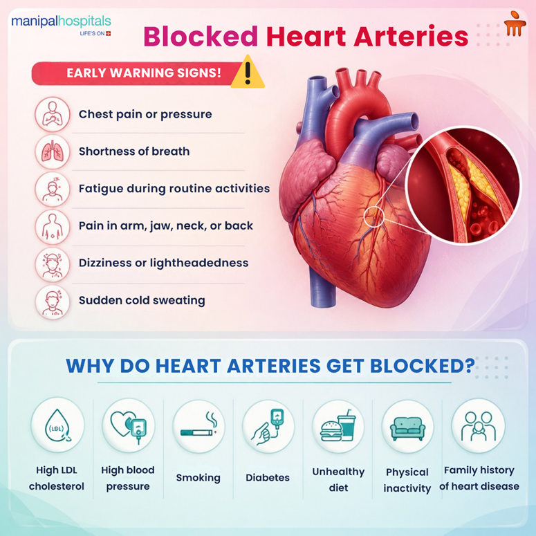 blocked-heart-arteries-causes-signs-treatment