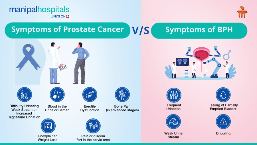 BPH vs Prostate Cancer: Symptoms, Tests and Treatment Guide
