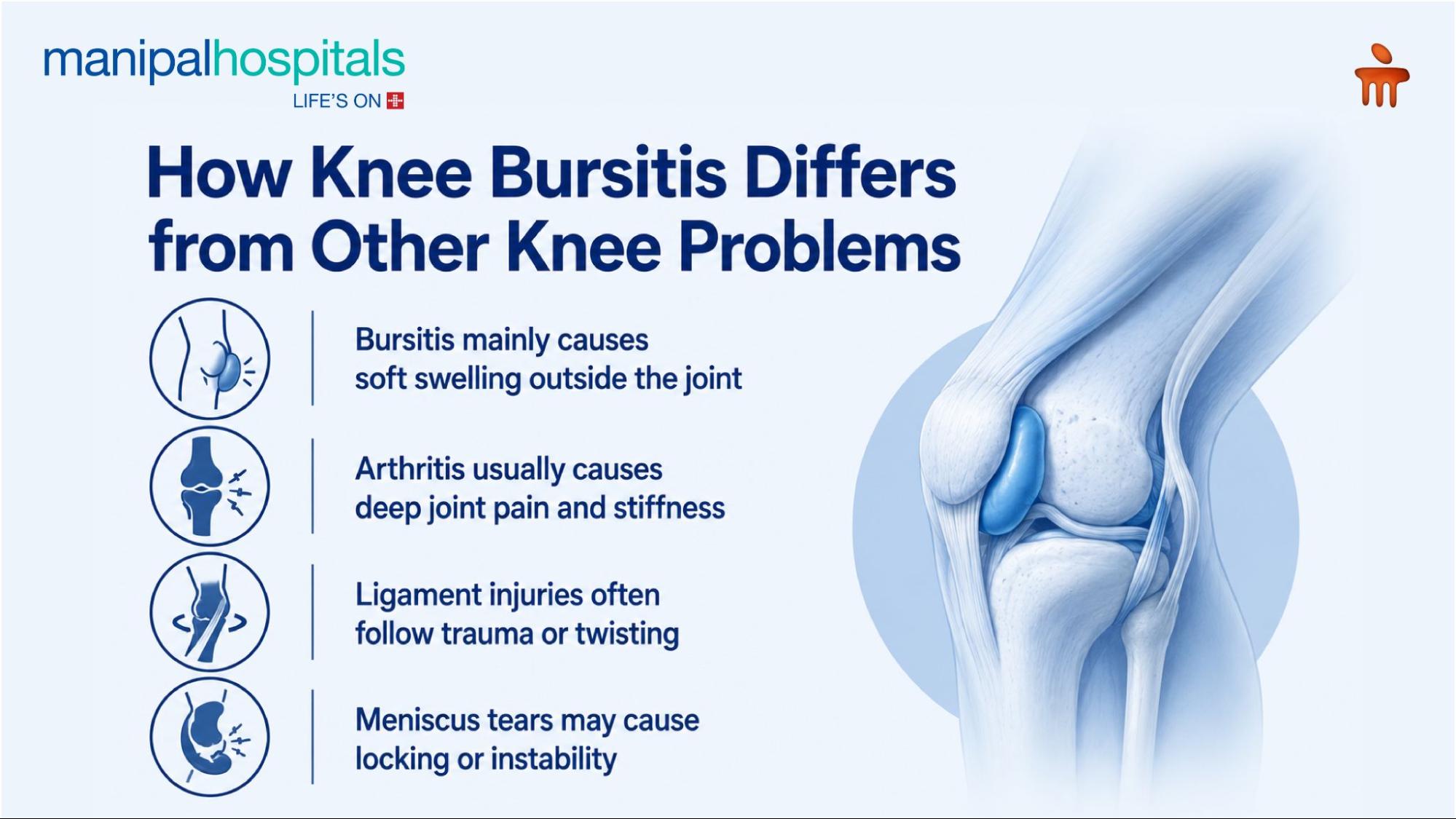 knee bursitis symptoms