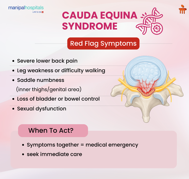 cauda-equina-syndrome-causes-and-surgery