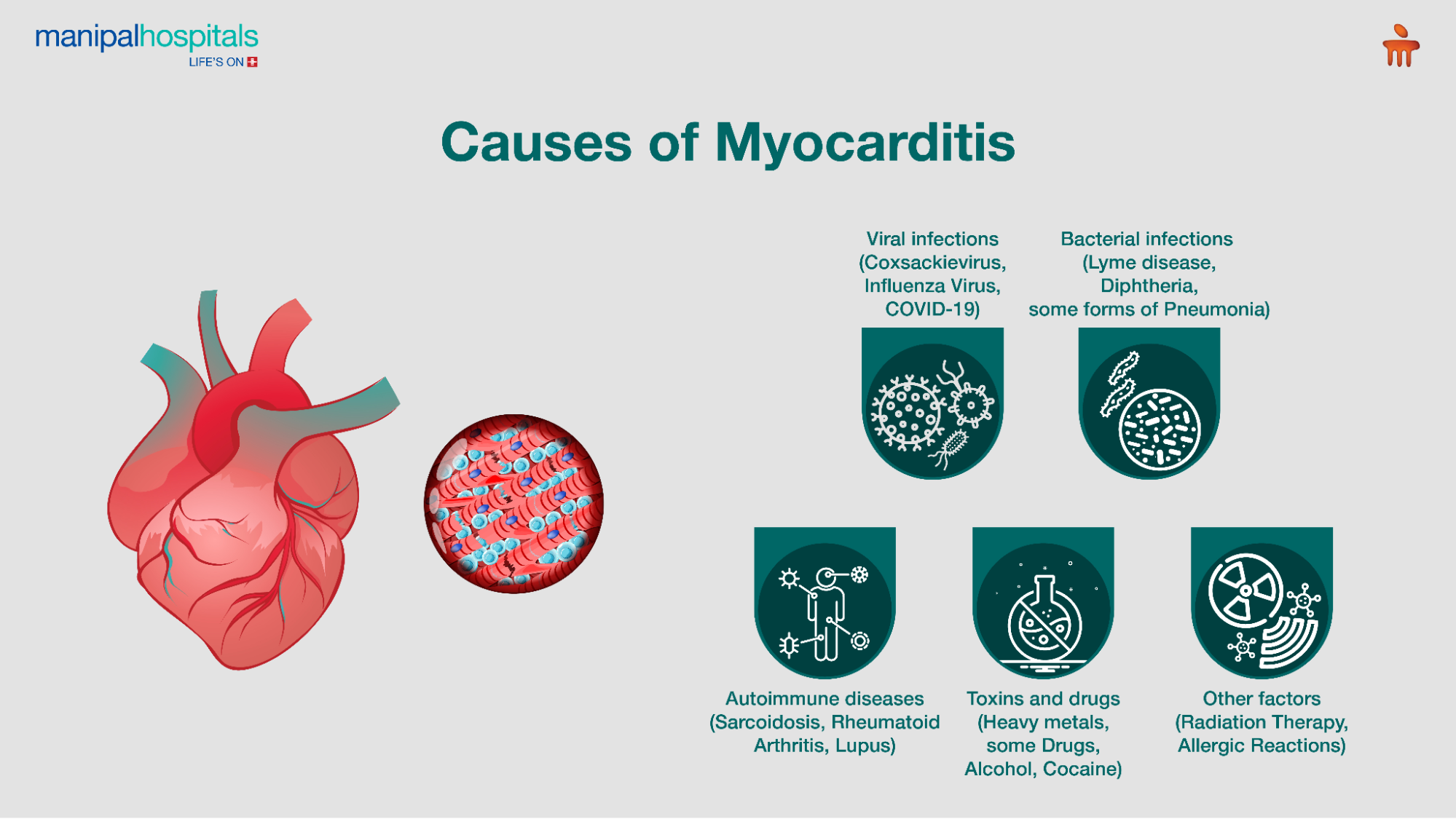 Causes of myocarditis