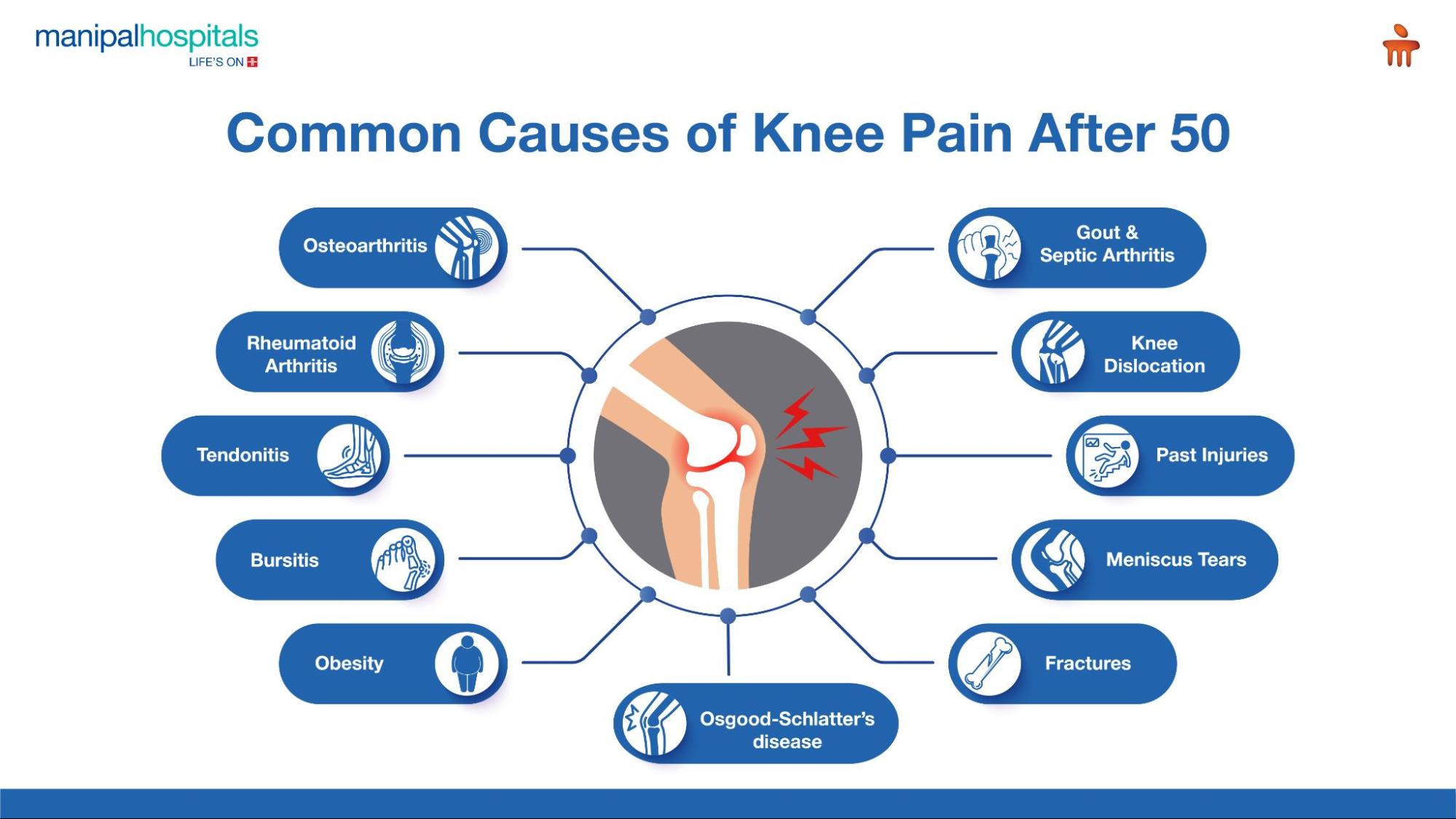 common causes of knee pain after 50