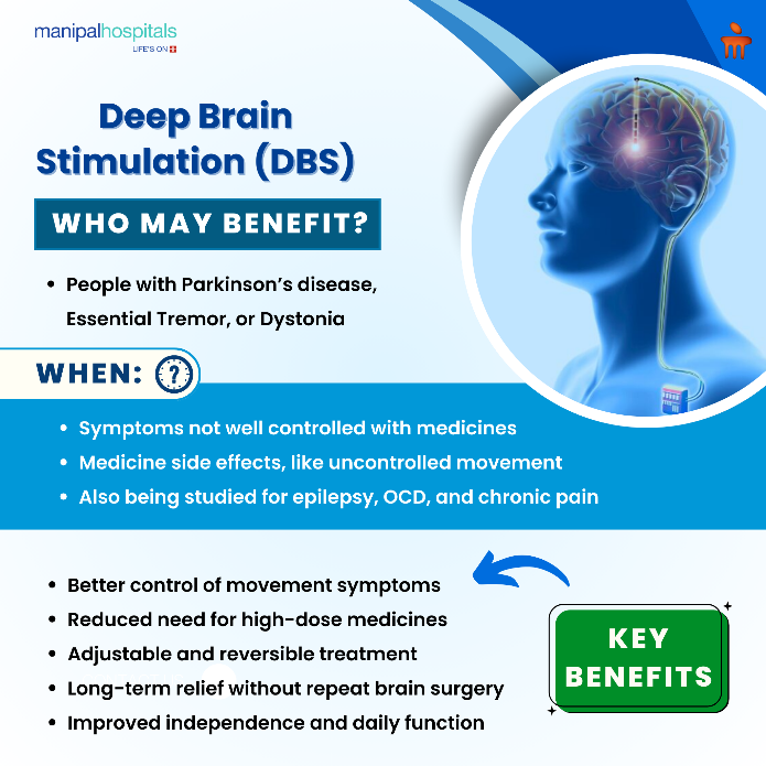 Who Can Benefit from DBS?