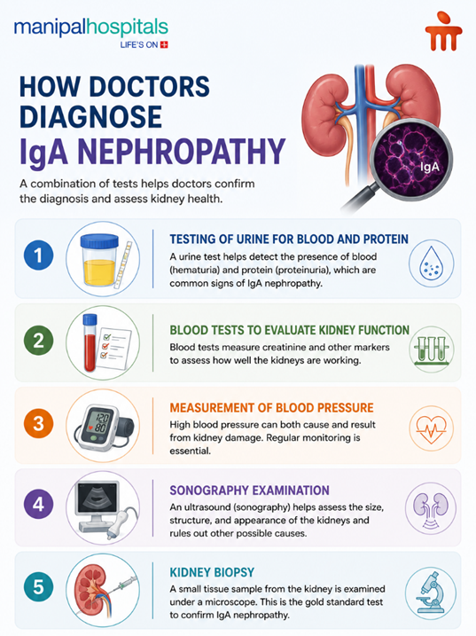 IgA Nephropathy: Symptoms, Causes, and Treatment Options Explained