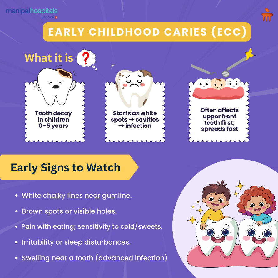 early-childhood-caries-ecc-prevention-tips