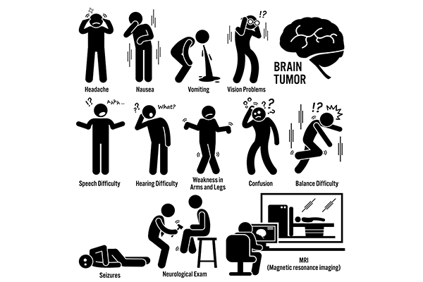 Early symptoms of brain tumour