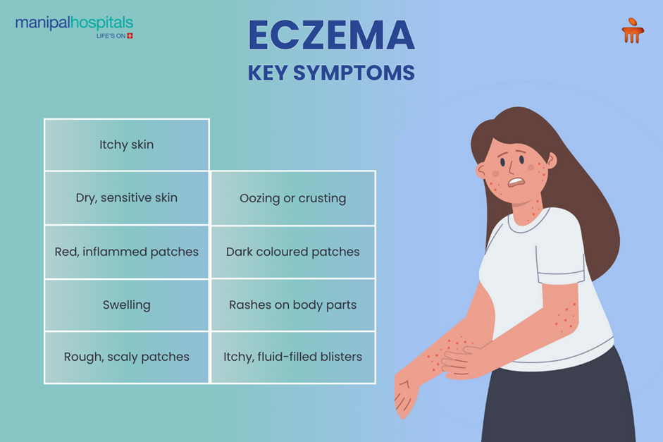 Eczema symptoms, types, and treatment options