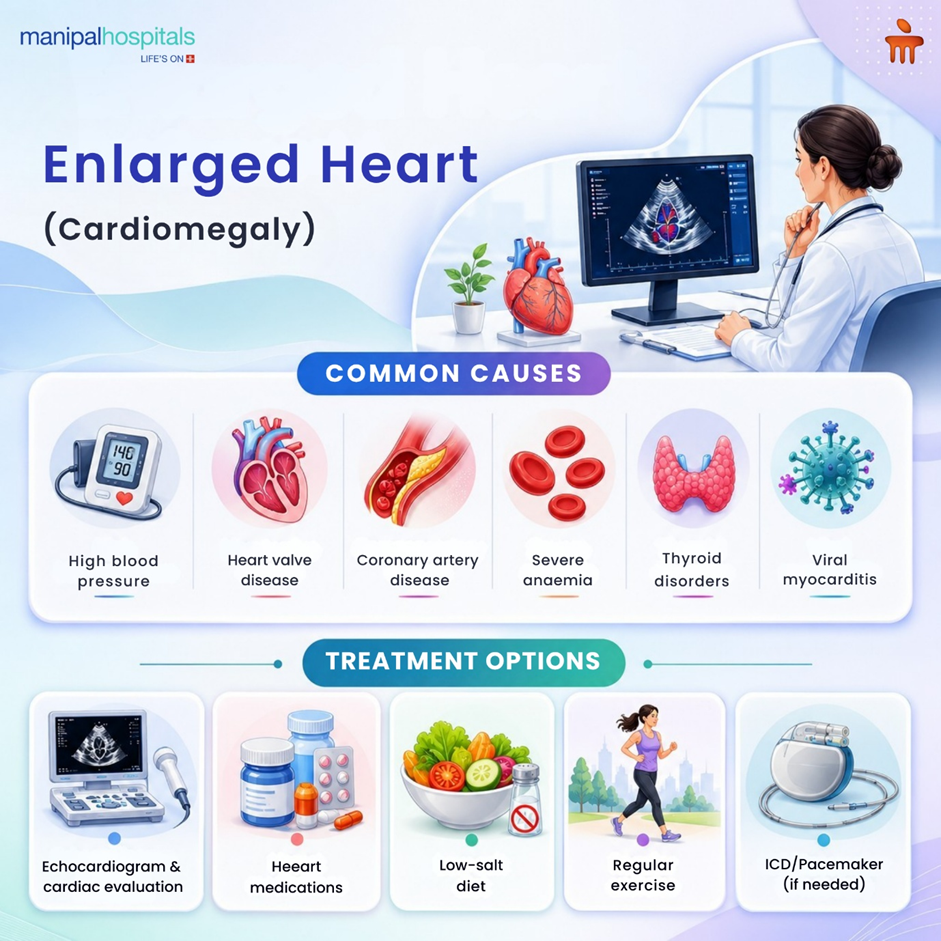Enlarged heart condition