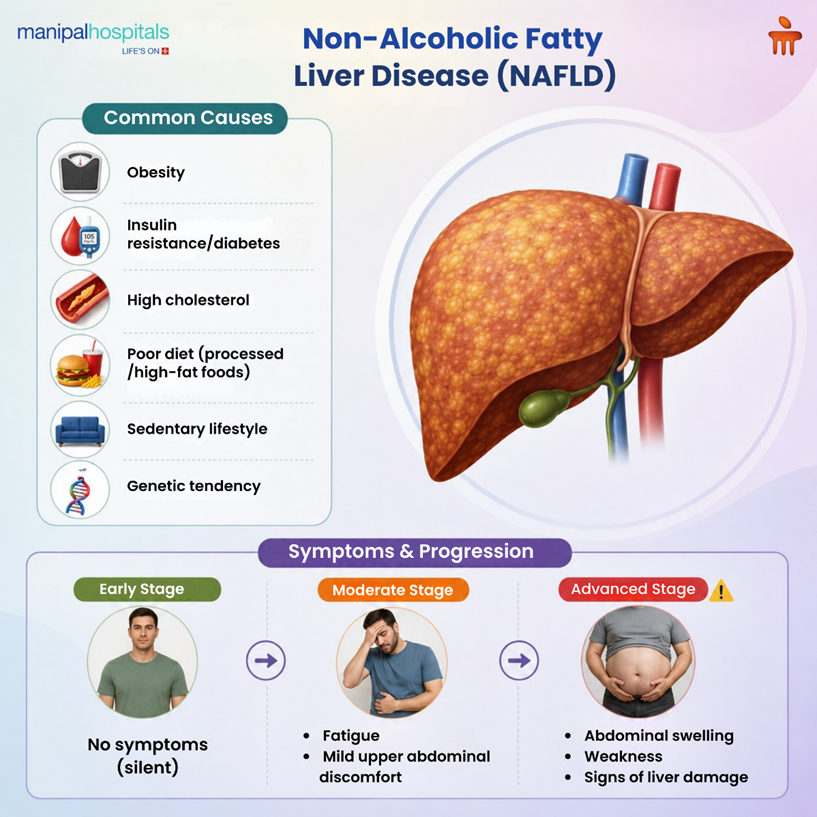 What is Non-Alcoholic Fatty Liver Disease? Causes, Symptoms & Treatment Options Understanding Fatty Liver Without Alcohol: A Complete Guide