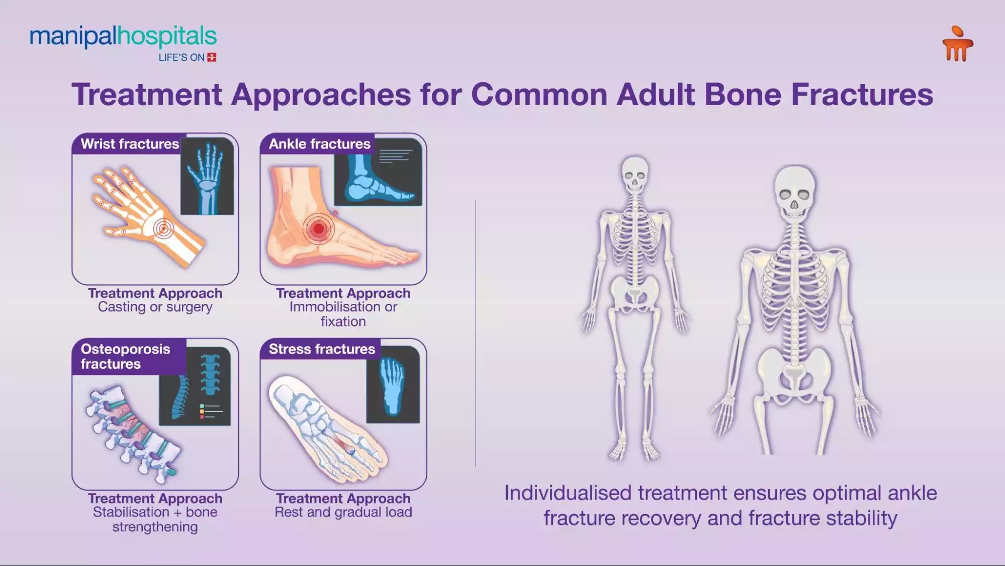 wrist fracture treatment