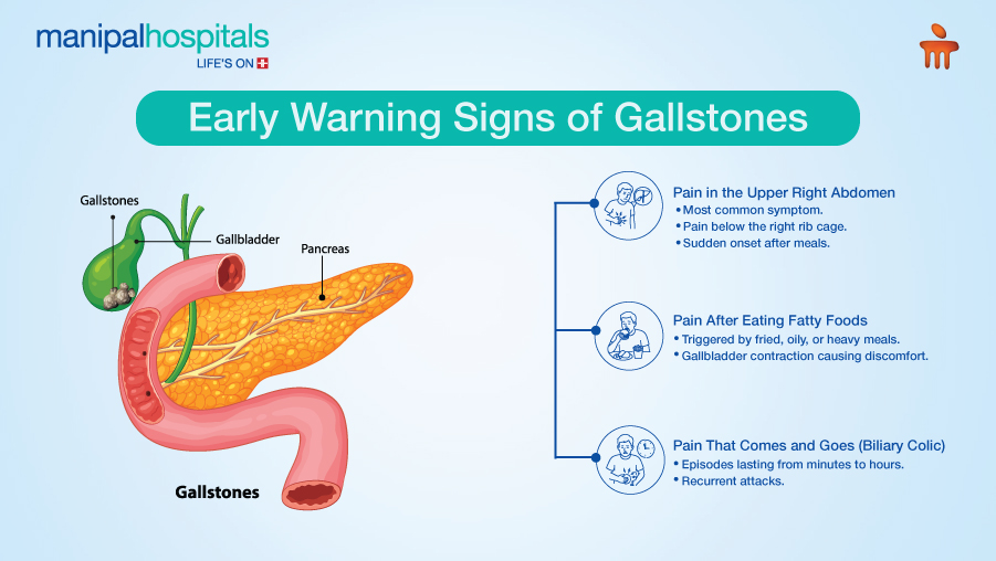 gallstone diagnosis