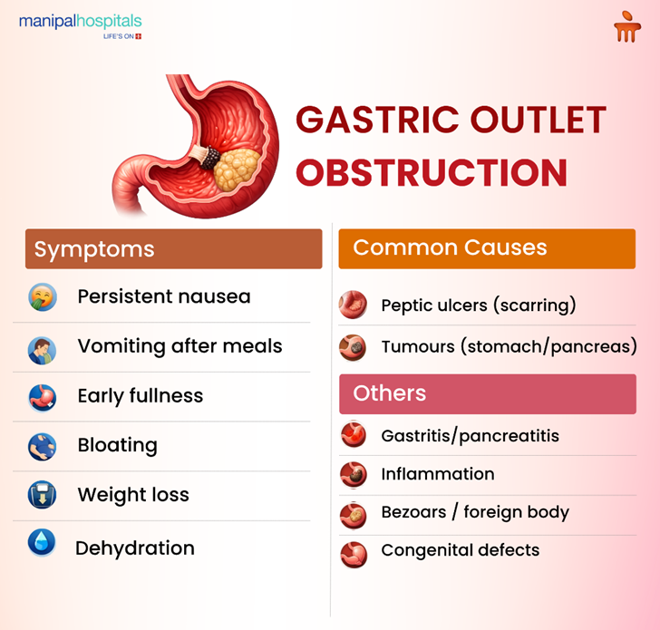 gastric-outlet-obstruction