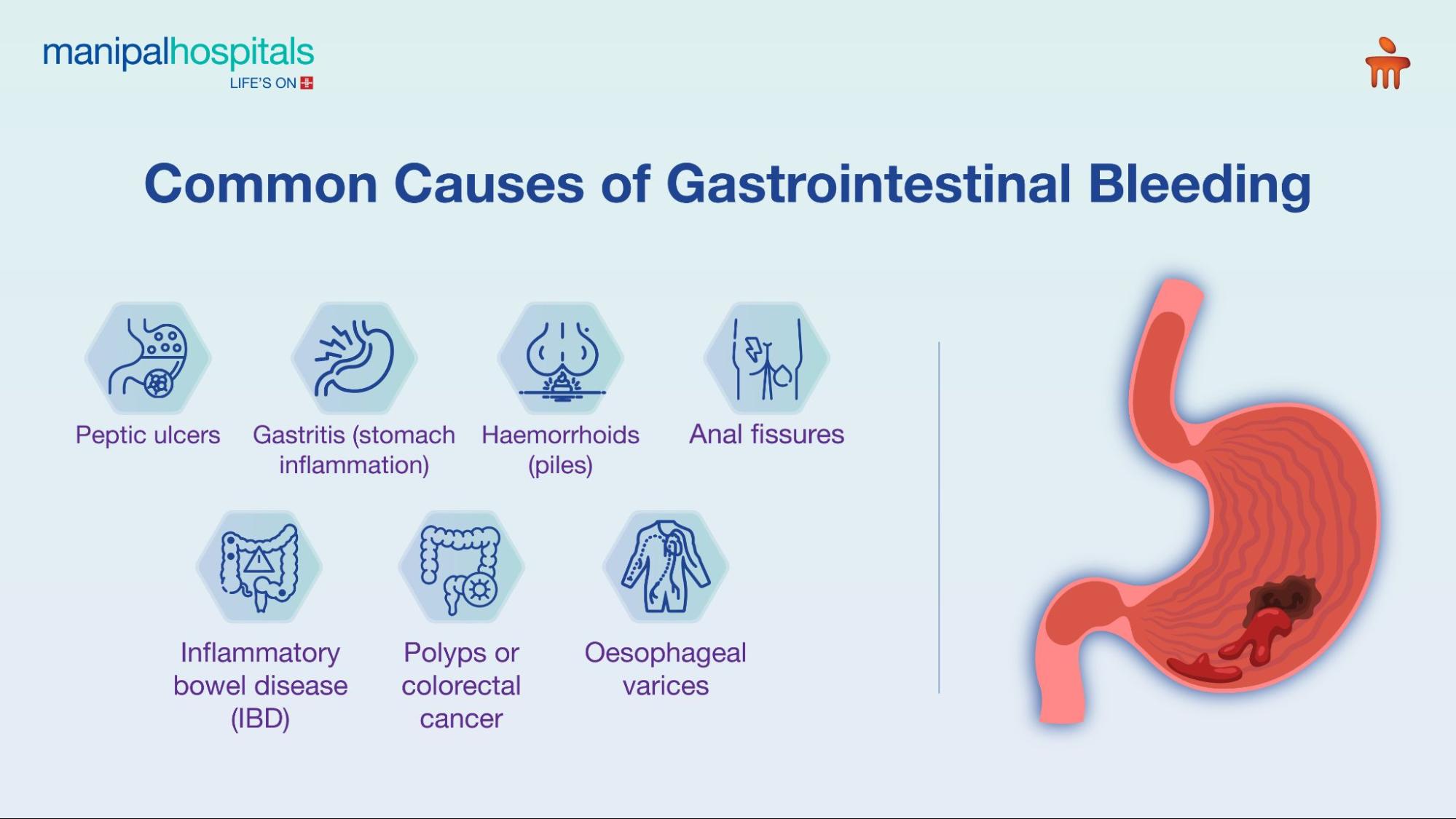 gastrointestinal bleeding