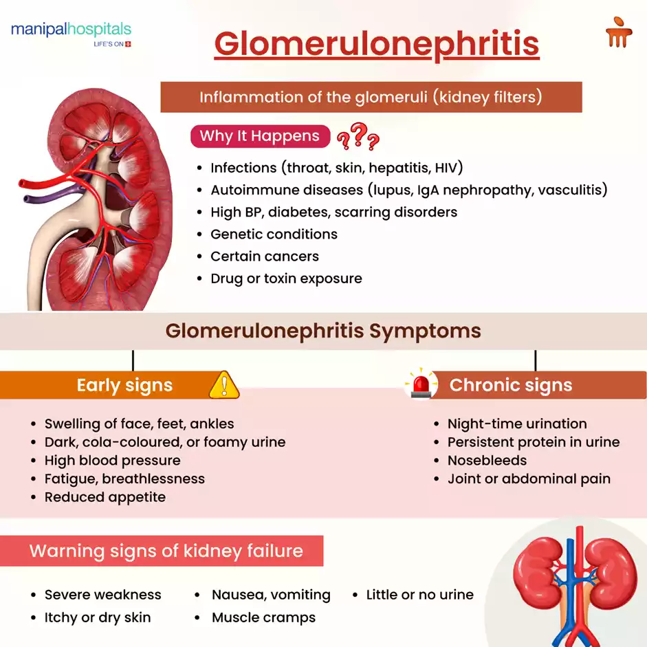 Kidney disease early signsx