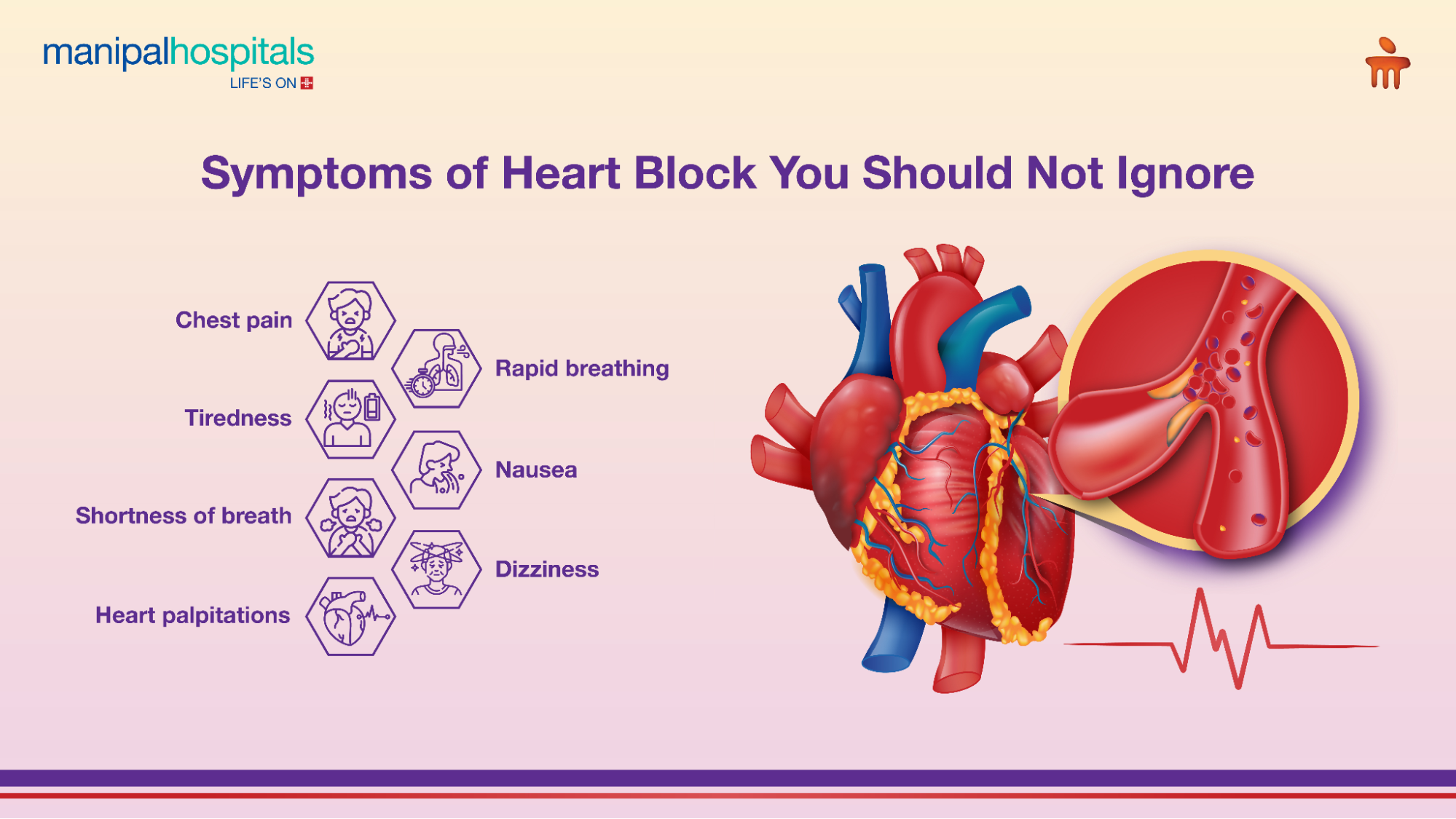 Third Degree Heart Block