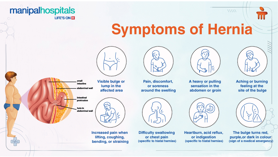 hernia-surgery-types-recovery-treatment-guide