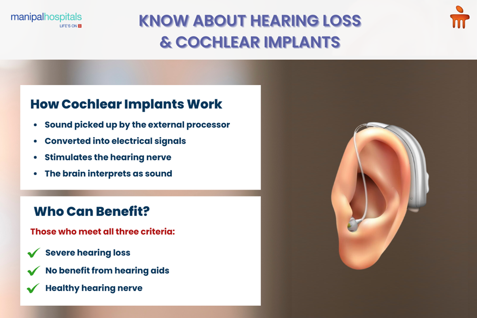 know about cochlear implants