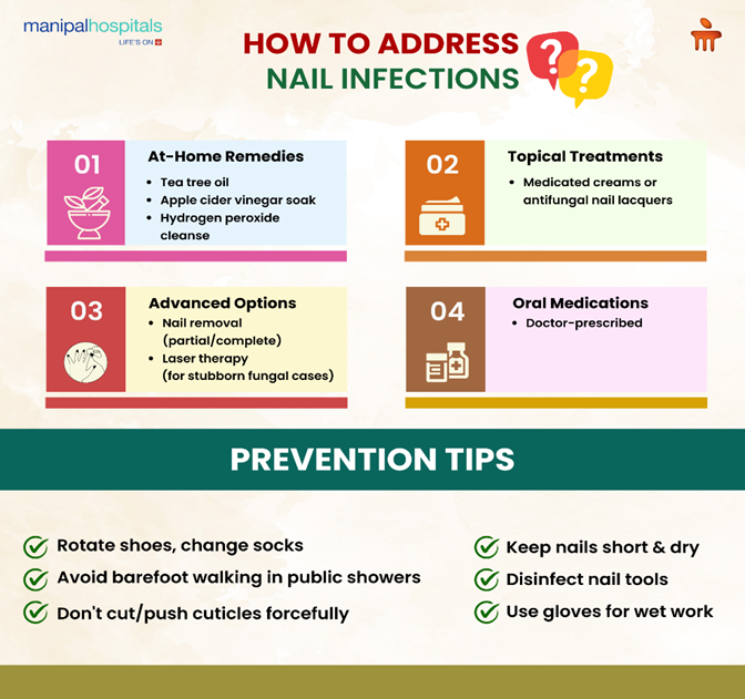 how to treat nail infection