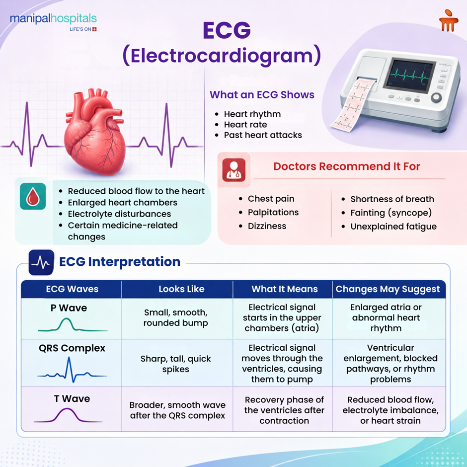 how-to-read-an-ecg-report
