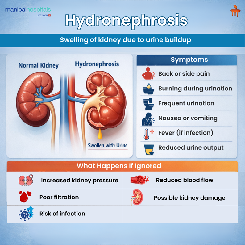hydronephrosis-causes-and-kidney-swelling