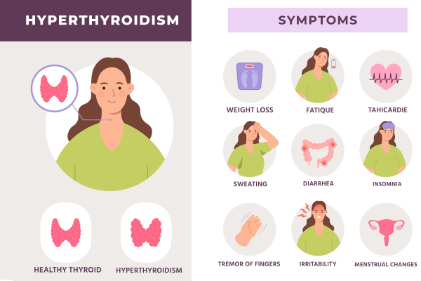hyperthyroidism treatment