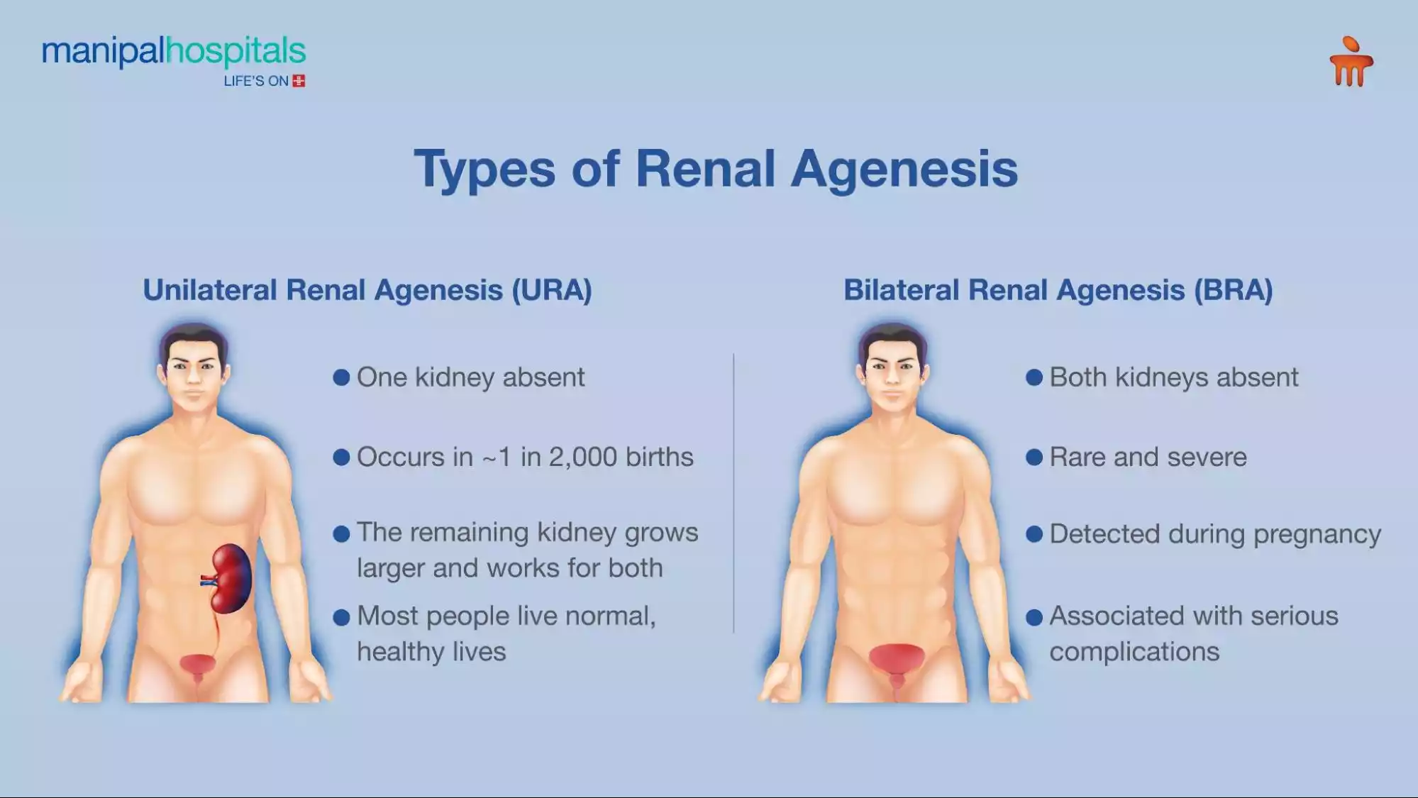 Renal agenesis early signs and patient information