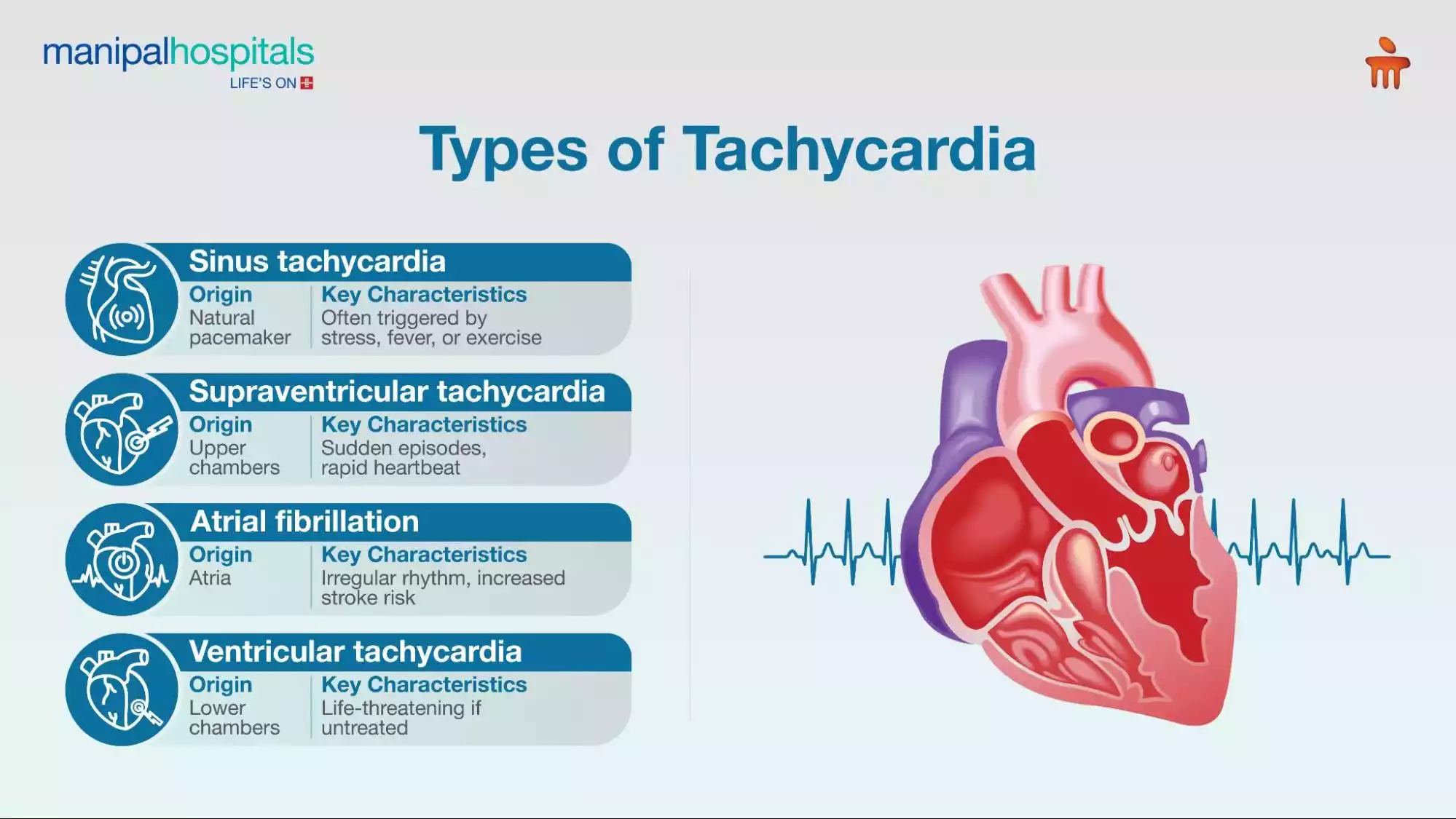 Tachycardia Symptoms: Causes, Warning Signs, and Treatment Tips
