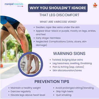 varicose-veins-don’t-ignore-leg-discomfort