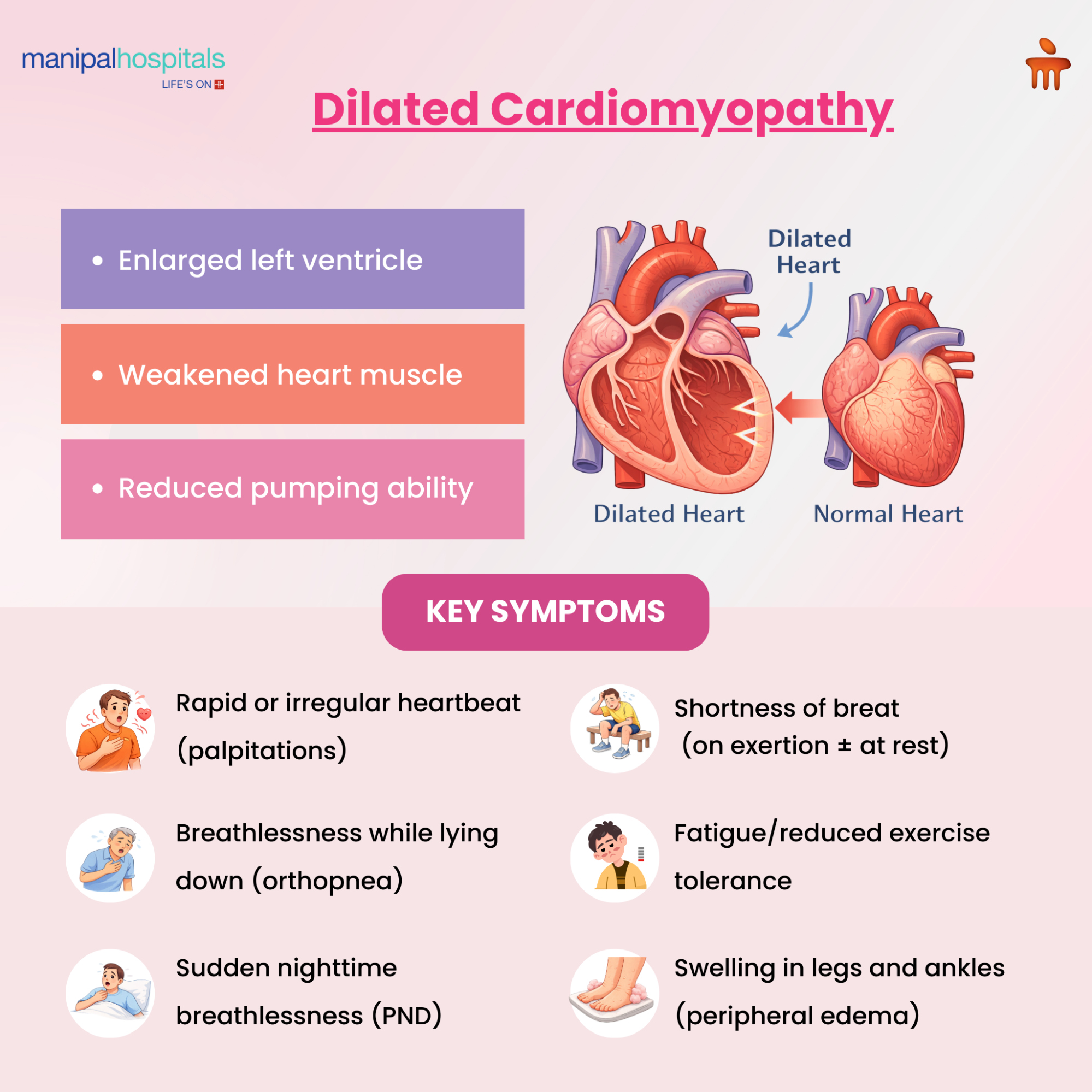 Cardiomyopathy: Causes, Symptoms, and Modern Treatment Options