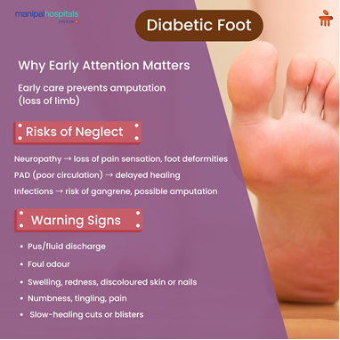 Diabetic Foot