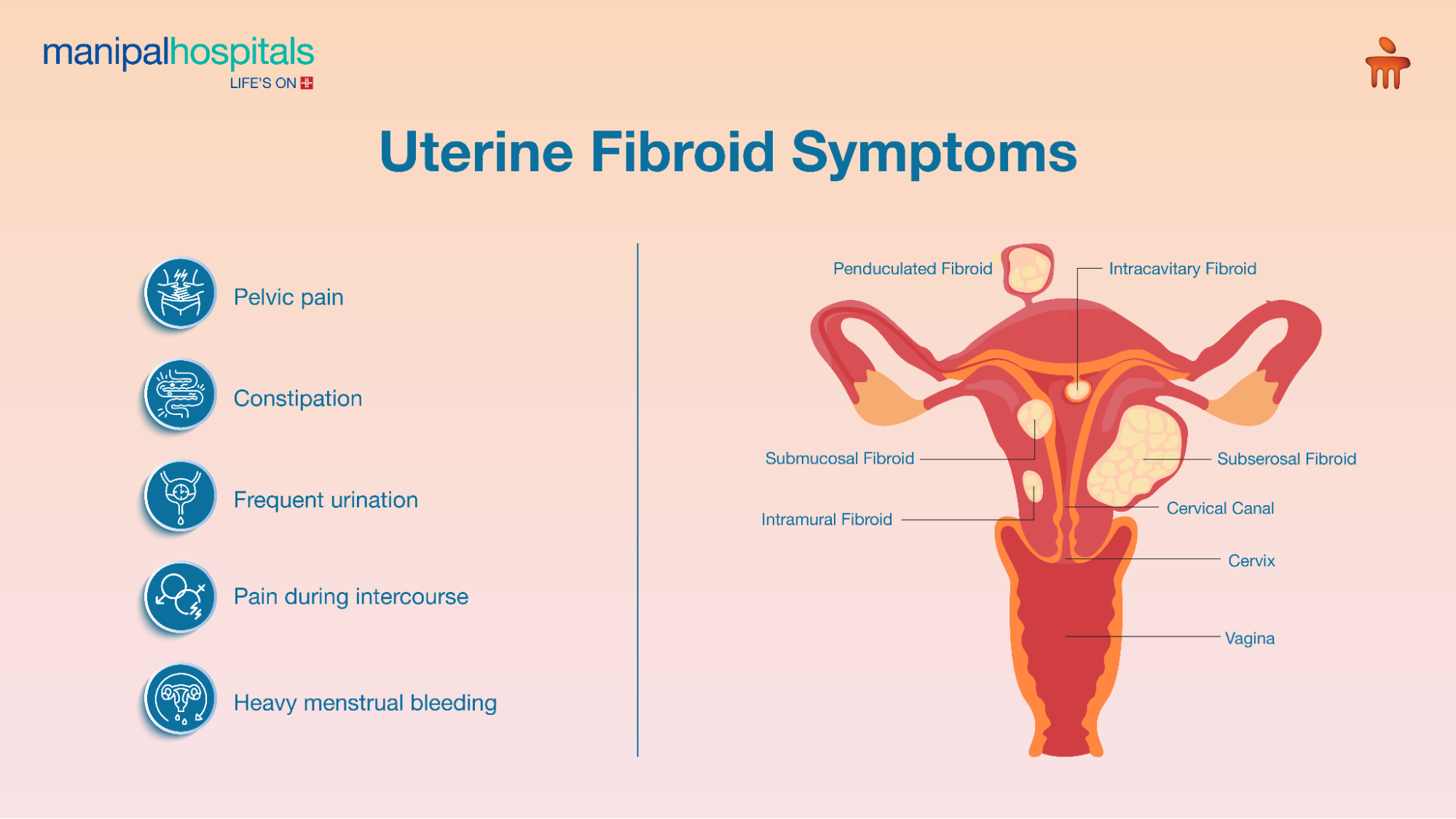 Uterine Fibroids