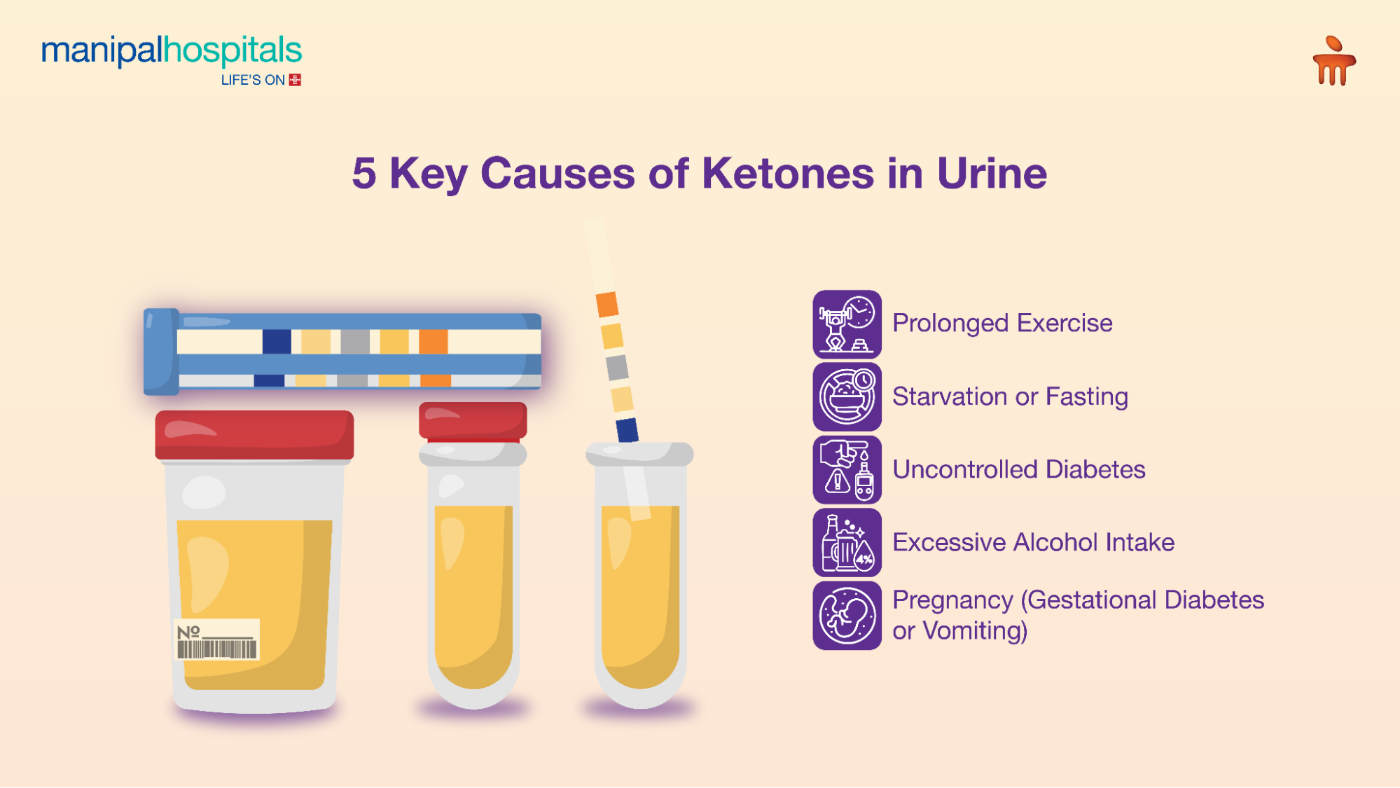 Ketones in Urine Explained: Causes, Symptoms & Remedies