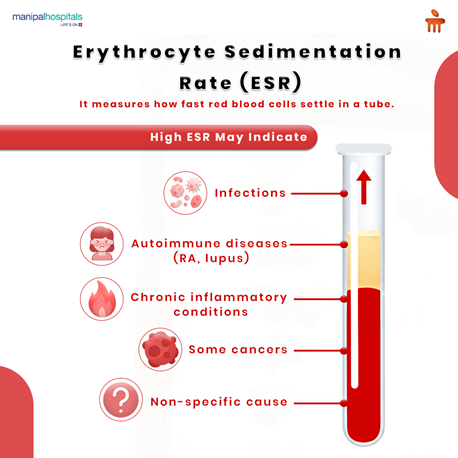 Erythrocyte Sedimentation Rate Explained