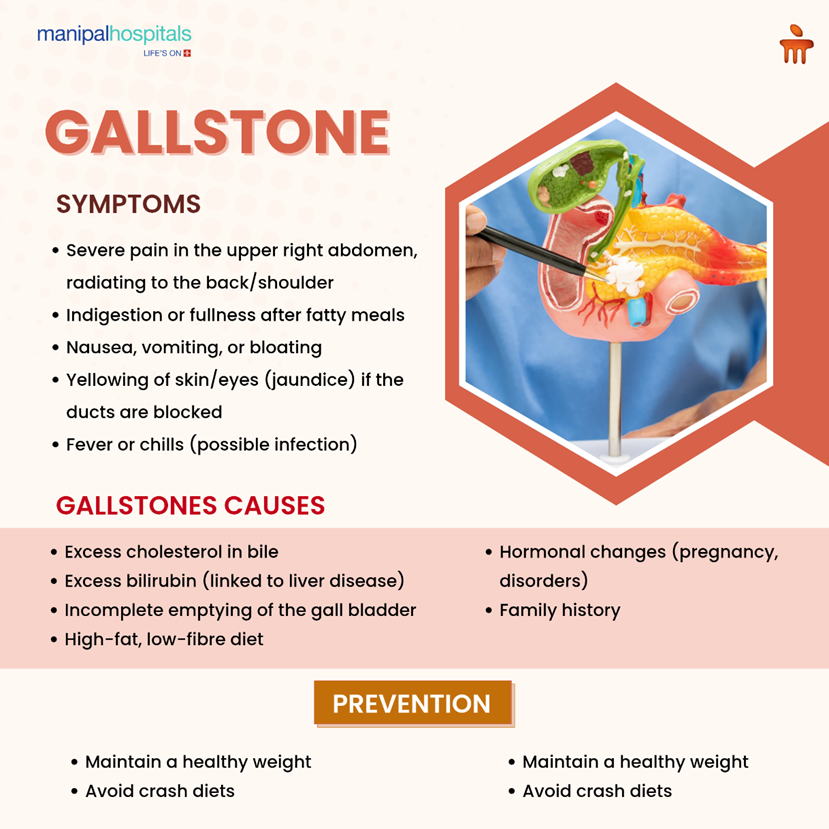 Gallstones Symptoms and Causes: When Surgery Is Needed