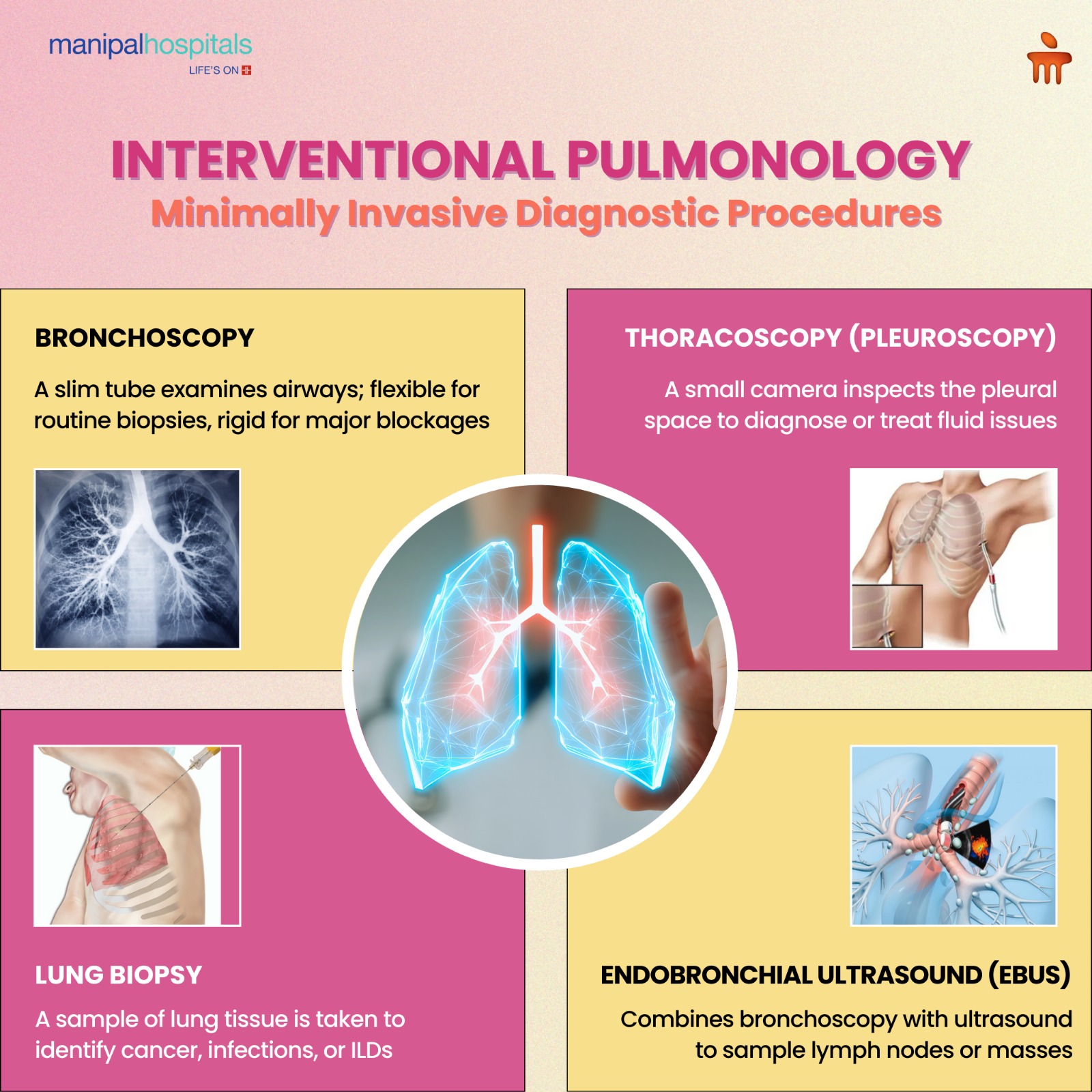 Interventional Pulmonology