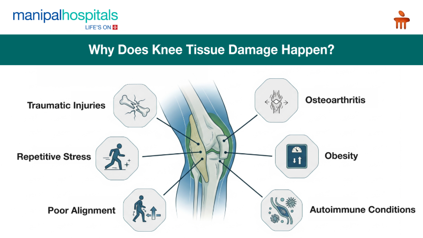 Knee tissue damage causes and treatment