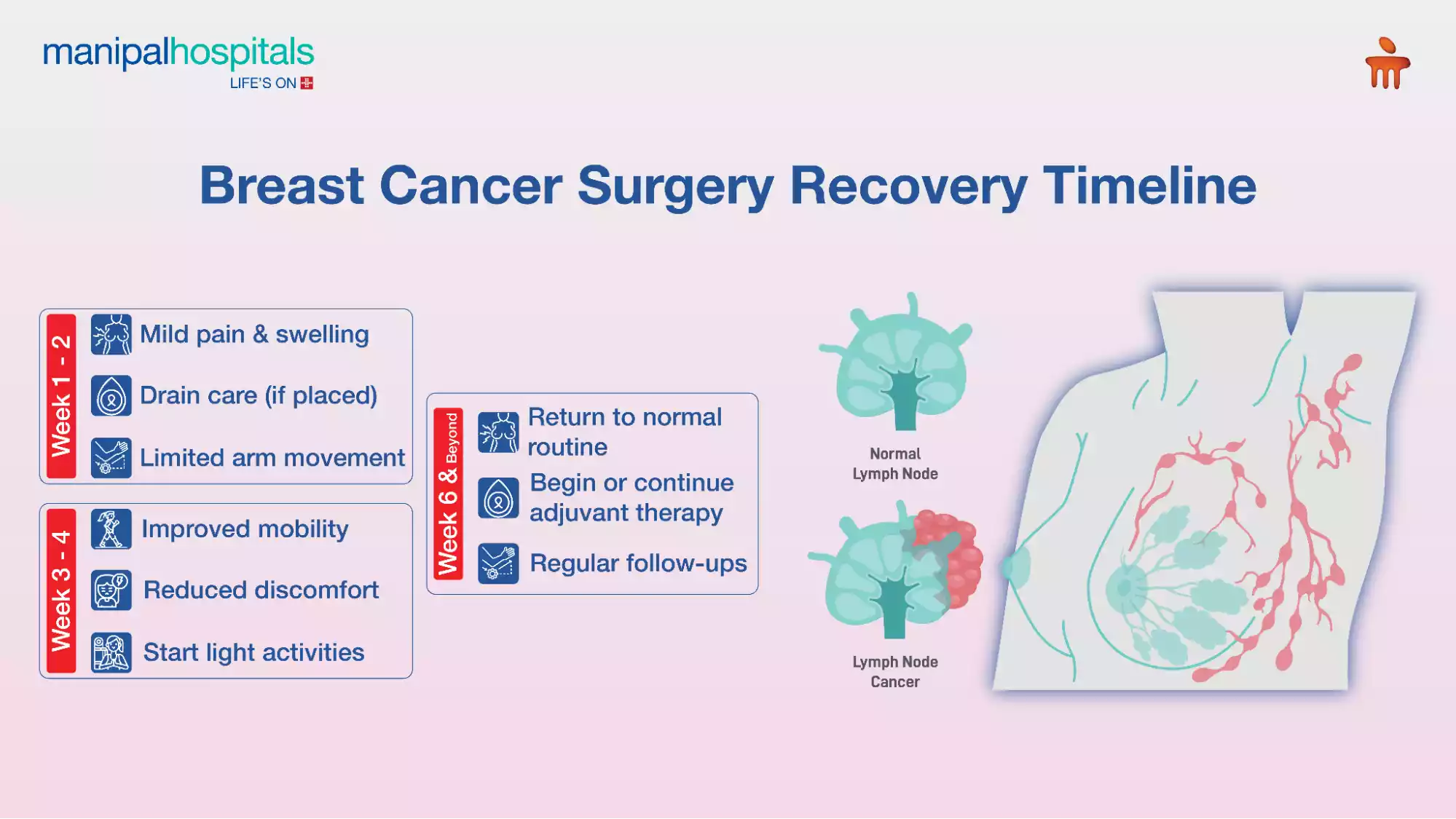 Breast Cancer Surgery
