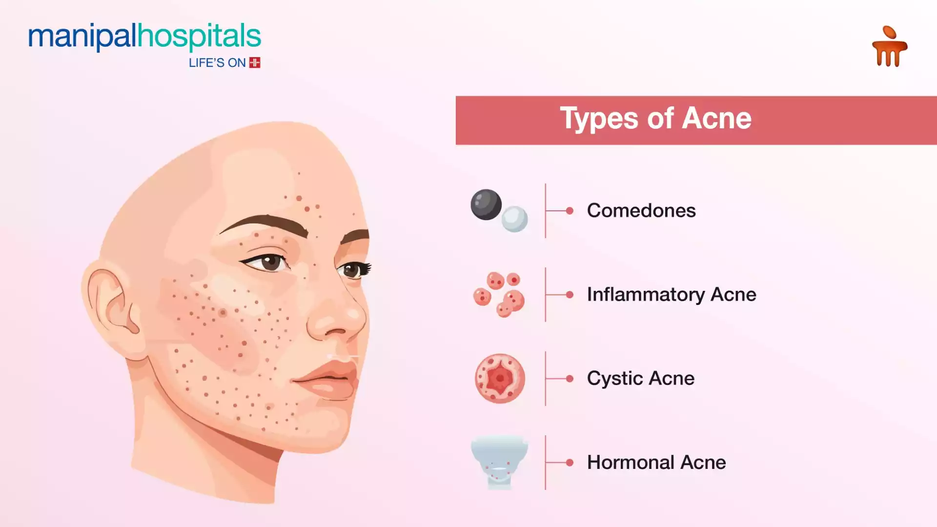 Understand acne causes, symptoms, and advanced treatment options designed to reduce inflammation, prevent scars, and clear skin faster.