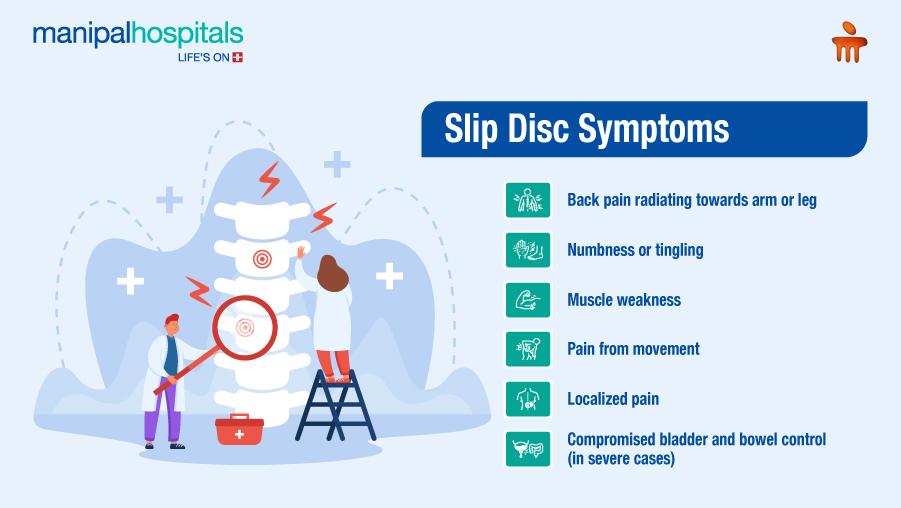 Slip Disc: Symptoms, Diagnosis & Treatment Guide