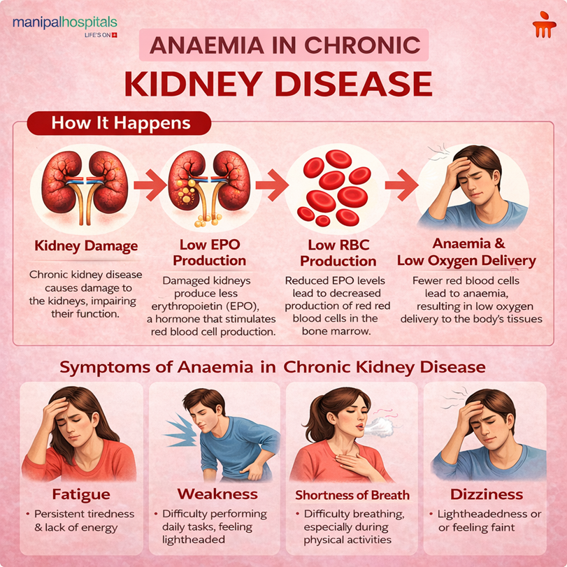 Anaemia in chronic kidney disease