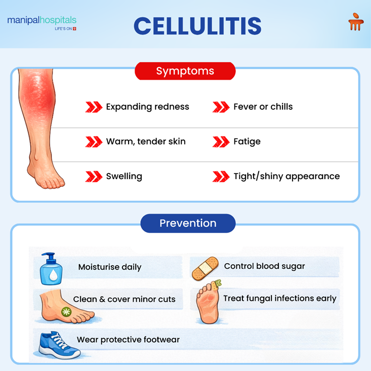 Cellulitis Treatment: Symptoms, Causes & Care