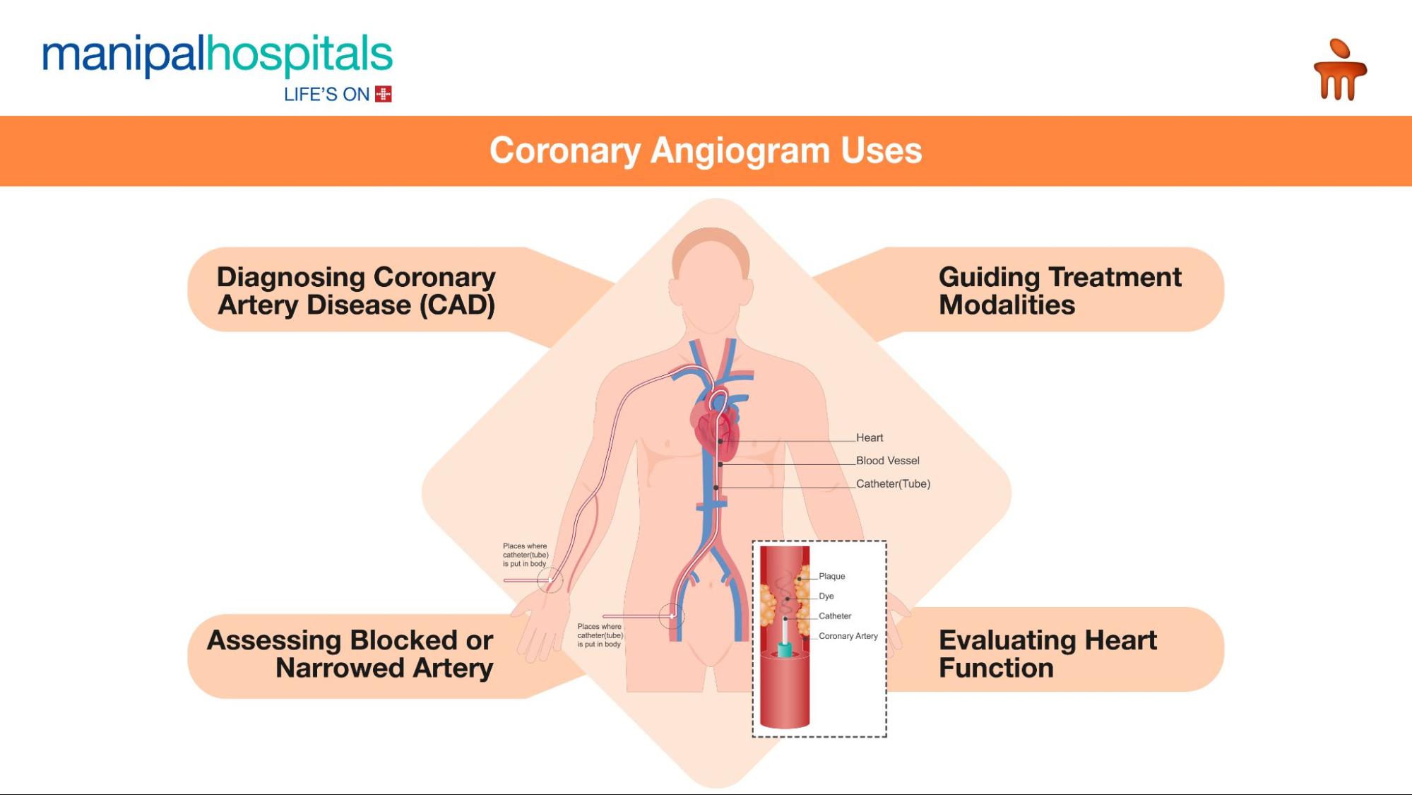 coronary angiogram procedure risks recovery