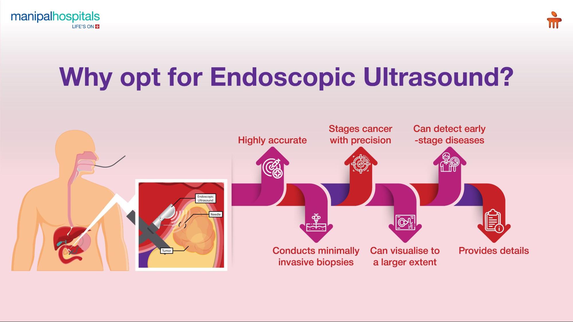 Endoscopic ultrasound for accurate GI condition diagnosis