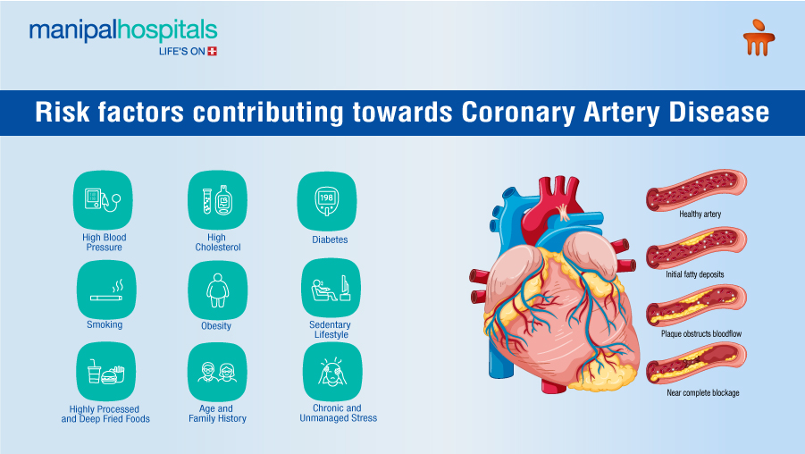 Coronary artery disease symptoms and treatment guide